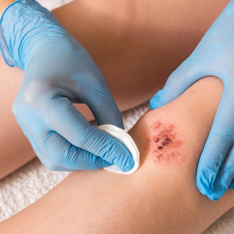 Behandlungspflege & Wundversorgung